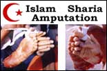 Sharia / Amputation