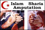 Sharia Amputation